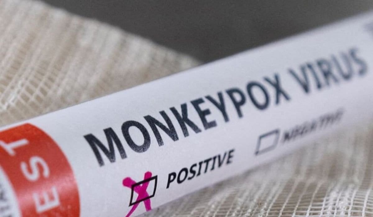 Attock Man Diagnosed with Monkeypox After Gulf Trip