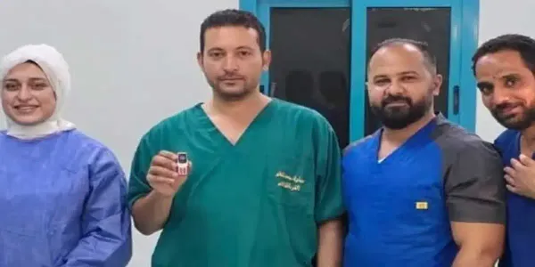 Doctors Remove Mobile Phone from Man’s Stomach in Egypt