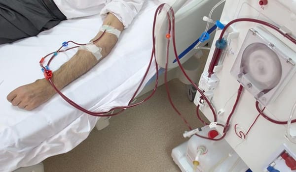 These Hospitals Offer Free Dialysis in Punjab