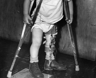 Polio